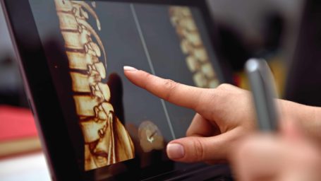Hand pointing on screen with X-rays of the spine. close up
