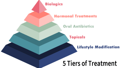 5 Tiers of Treatment: Lifestyle Modification, Topicals, Oral Antibiotics, Hormonal Treatments and Biologics