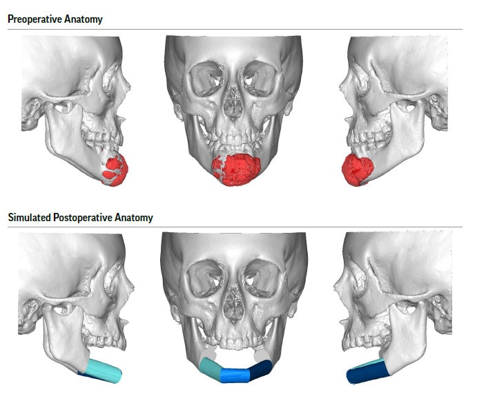 case study on otolaryngology