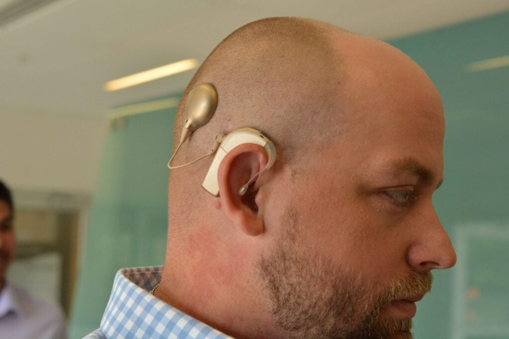 close up of a man's head, showing a cochlear implant