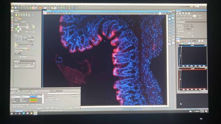 red and blue tissue section on screen