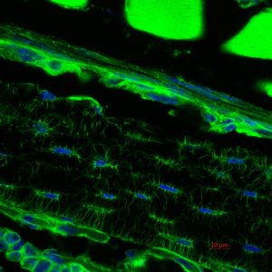 Phalloidin staining (green) on cortical bone from a 1 month-old female CrtapKO mouse reveals the osteocytes’ delicate dendritic network.