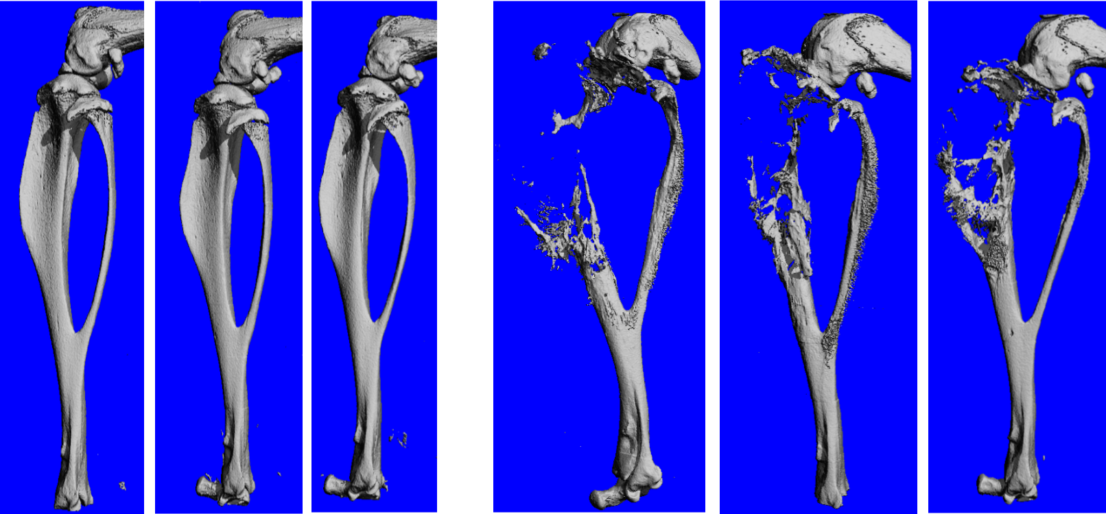 CT images of tibias
