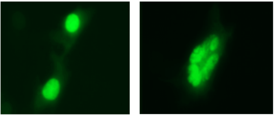 Comparison image of healthy and apoptotic osteocytes