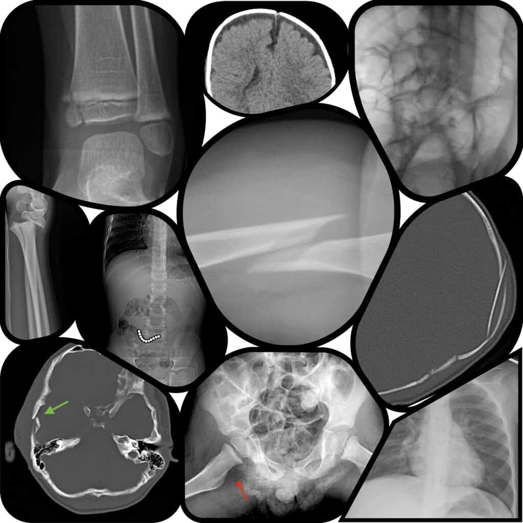 collection of pediatric radiology images