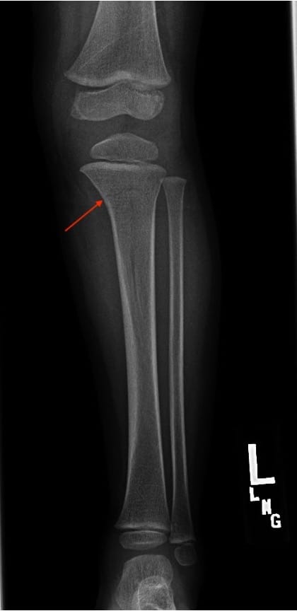 Lower Extremity Radiography